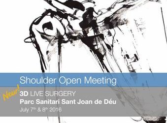 3D live surgery – San Joan de Deus